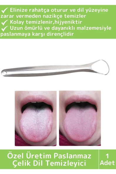 Özel Yüksek Kaliteli Paslanmaz Çelik Kolay Temizlenir Ağız Kokusu Önleyici Hijyenik Dil Temizleyici ürün görseli 1