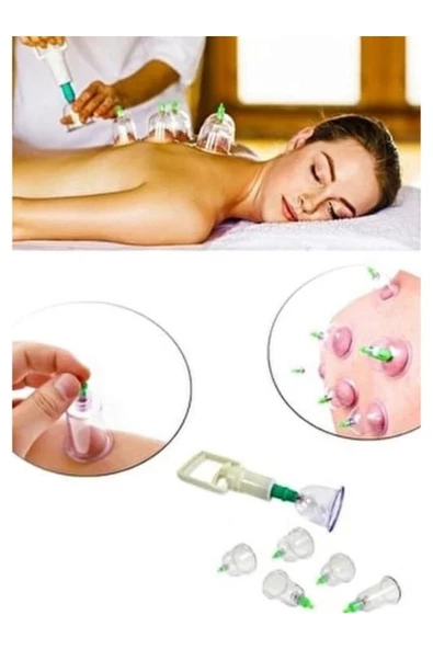 canlipetshop 6 Lı Masaj Seti Hacamat Kupası Seti Vakumlu Masaj Seti Masaj Aleti ürün görseli 1