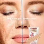 Solante Acnes Sun Care Losyon SPF50 150 ml thumbnail 2
