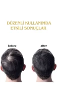 FORX5 Sarı Serum& Dermaroller Set thumbnail 3