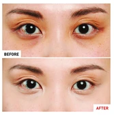 Erborian Super BB Concealer Nude  – Kapatıcı 10 ml thumbnail 3