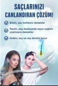 Minox Lipozomal Şampuan 300 ml thumbnail 2