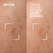 Dr. Brandt Triple Active Retinol 30 ml thumbnail 4