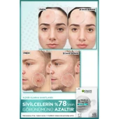 Pimple Patch 22'li Sivilce Bandı / Hidrokolloid Bant thumbnail 4