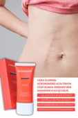 Scarderm Onarıcı Jel thumbnail 4