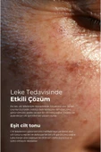 Tto Clinic Leke Kremi 75ml thumbnail 4