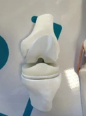Diz Eklemi Modeli - Diz Eklemi Maketi thumbnail 2