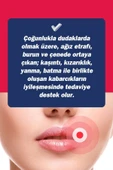 Tto Ux Uçuk Kremi 10ml thumbnail 2