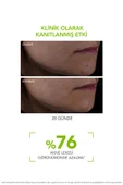 BİODERMA Sebıum Serum thumbnail 3