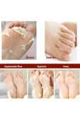 Miracle Foot Peeling Pack-çorap Tipi Ayak Peeling Maskesi thumbnail 3