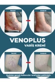DERMONEM Venoplus Kremi thumbnail 4