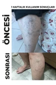 DERMONEM Venoplus Kremi thumbnail 3