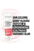 Neutrogena Sivilce Karşıtı Jel Nemlendirici 50 ml thumbnail 4