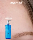 Esomed Yüz Temizleme Jeli 200 ML thumbnail 6