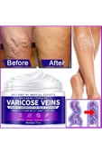 Xlan Maximum Strength Varicose Veins Krem 100 ml 1 Adt thumbnail 2