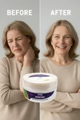 Süper Fıtık Kurutan Krem 50 Ml thumbnail 1
