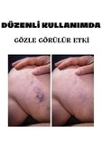 Süper Varicose Veins Var.is Kremi 100 ML thumbnail 3