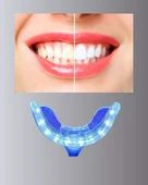 Diş Beyazlatma Seti thumbnail 2