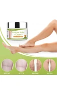 Varicose Veins Var.is Kremi 100 ML thumbnail 2