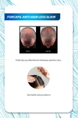 ARKOPHARMA Forcapil Elixir Saç Dökülmesi Karşıtı Solüsyon 50ml thumbnail 3