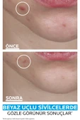 LA ROCHE POSAY La Roche-Posay Effaclar Duo+M Patch 22 Patch thumbnail 3