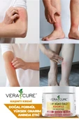 Vera Cure Çay Ağacı Özlü Kükürtlü Krem (150ML) thumbnail 2