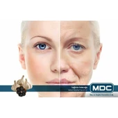 MDC Black Garlic (SİYAH SARIMSAK) 30 Tablet thumbnail 4