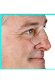 MEDİKALCİM Gel Pad thumbnail 2