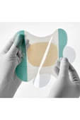 MEDİKALCİM Comfeel® Plus Contour thumbnail 2