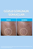 La Roche Posay Effaclar Gel 400 Ml thumbnail 4