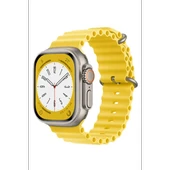Newface Apple Watch 42mm Ocean Kordon - Sarı thumbnail 2