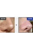 - One Day Exosome Shot Pore Ampoule 2000 thumbnail 4