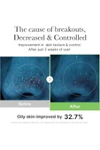 Exosome CICA Tonik(GLOBALCARE) thumbnail 8