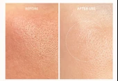 ARENCIA NAD + BOOSTER SHOT 30 ML thumbnail 4