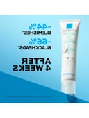 40ml Sivilce ve Siyah Nokta Kremi thumbnail 3