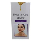 Sivilce Ve Akne Serumu 20 ML thumbnail 3