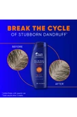 Head & Shoulders Clinical Strength Şampuan 400ML thumbnail 6