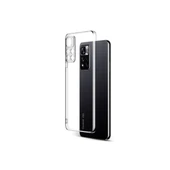 Xiaomi Redmi Note 11 Pro Plus 5g Kılıf Lüx Şeffaf Silikon thumbnail 2