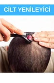 Derma Roller System 540 Titanyum İğneli 1 Mm thumbnail 10
