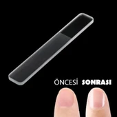 Cam Tırnak Törpüsü thumbnail 4