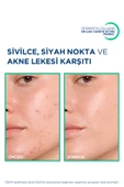 Bioderma Sebium Kerato Cover 30 ml thumbnail 2