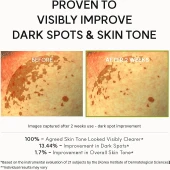 Arencia Retinal Booster Shot thumbnail 5
