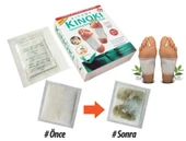Detox Ayak Bandı (10 Adet) thumbnail 1