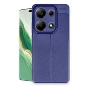 13 4G Auto Focus Kapak - Lacivert thumbnail 1