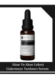 Ephesus Sivilce Karşıtı. Serum 20 ml thumbnail 1