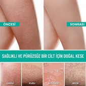 Dermapeel Orta Floş Banyo Kesesi thumbnail 4