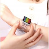 E2M Apple Watch 38-40mm KRD-22 Candy Sarı Kordon thumbnail 3