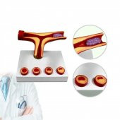 Damar Tıkanıklığı Model 46 thumbnail 1