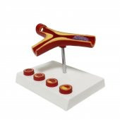 Damar Tıkanıklığı Model 46 thumbnail 2
