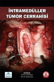 İntramedüller Tümör Cerrahisi thumbnail 2